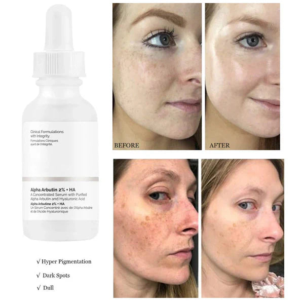 The Ordinary - Alpha Arbutin 2% + HA